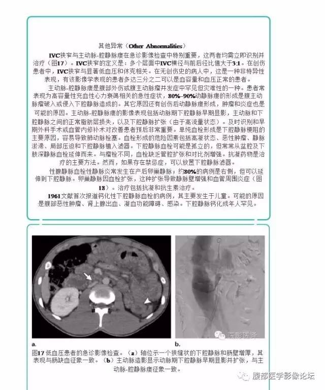 下腔静脉疾病的影像诊断