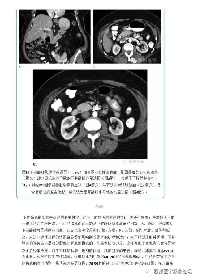 下腔静脉疾病的影像诊断