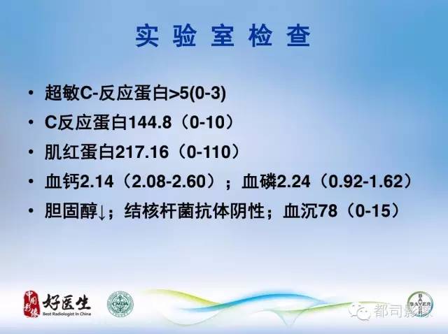 【PPT】骨关节影像病例分析