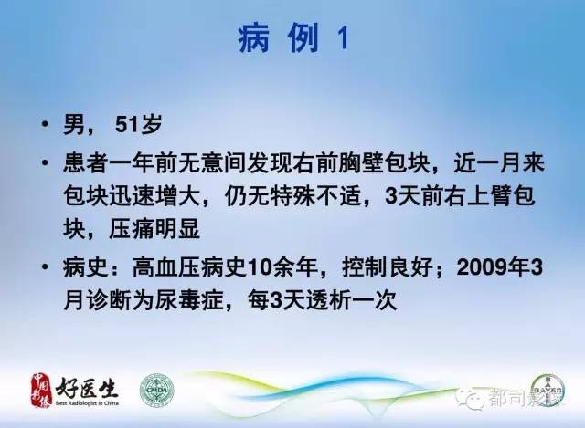 【PPT】骨关节影像病例分析