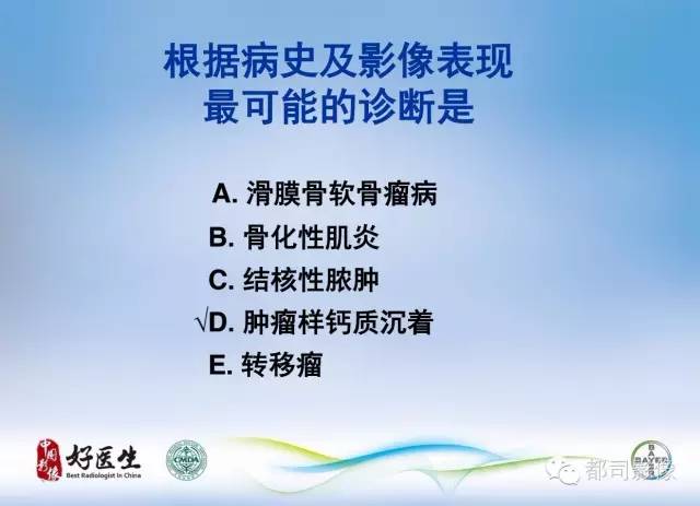 【PPT】骨关节影像病例分析