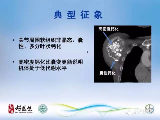 【PPT】骨关节影像病例分析