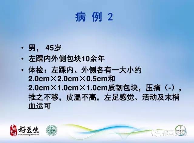 【PPT】骨关节影像病例分析
