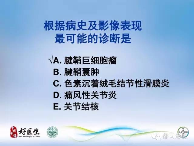 【PPT】骨关节影像病例分析