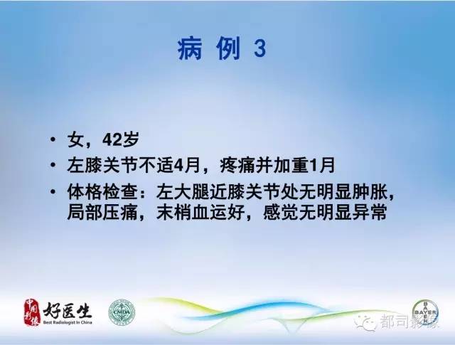 【PPT】骨关节影像病例分析
