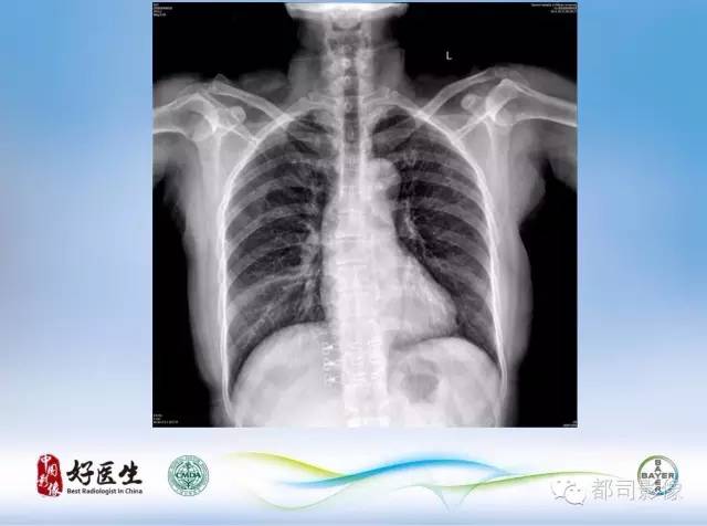【PPT】骨关节影像病例分析