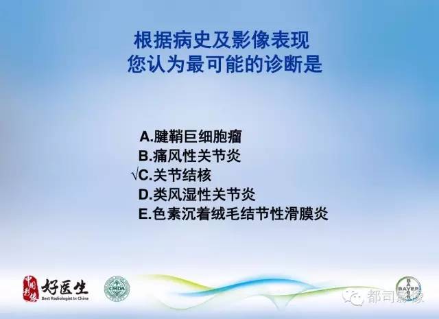 【PPT】骨关节影像病例分析