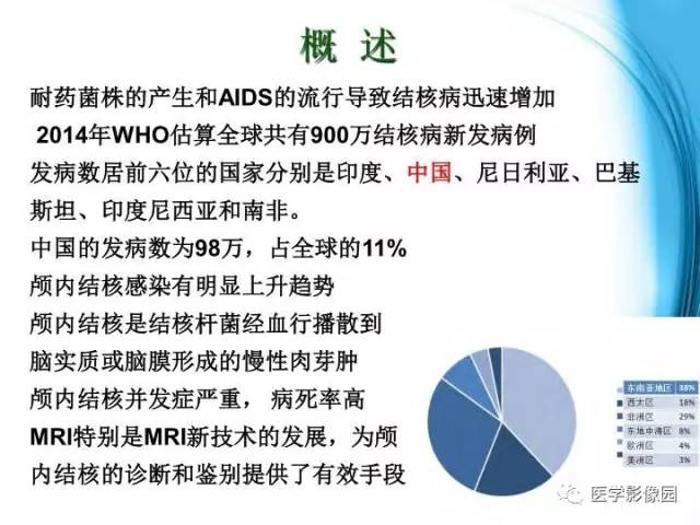 【PPT】颅内结核的磁共振诊断与鉴别