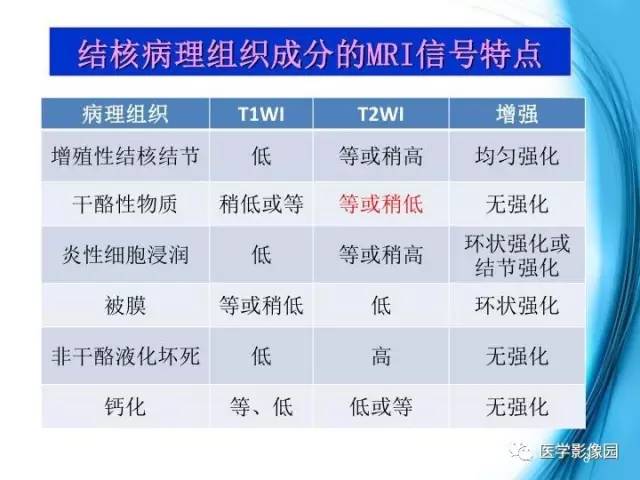 【PPT】颅内结核的磁共振诊断与鉴别