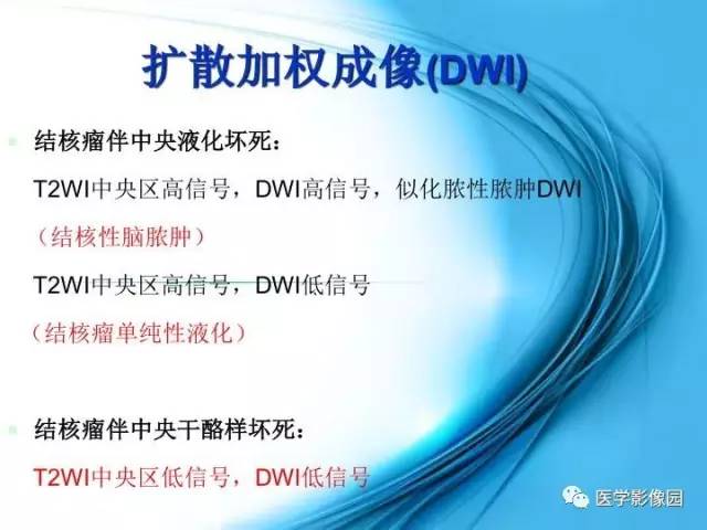 【PPT】颅内结核的磁共振诊断与鉴别