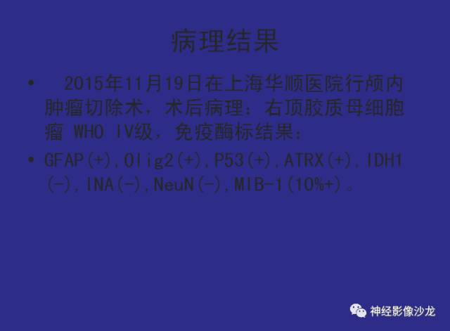 【病例】右顶叶胶质母细胞瘤1例MR影像表现