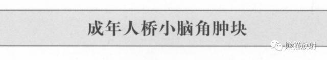 “成人桥小脑角肿块”的鉴别诊断