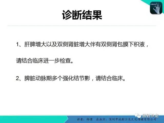 【病例】脾硬化性血管瘤1例CT影像表现与鉴别