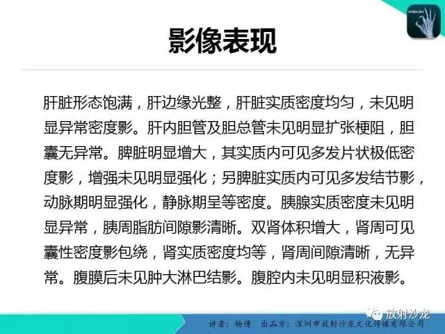 【病例】脾硬化性血管瘤1例CT影像表现与鉴别