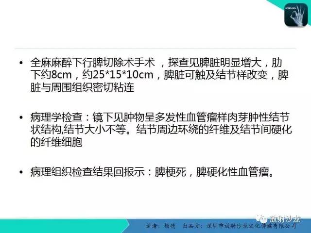 【病例】脾硬化性血管瘤1例CT影像表现与鉴别