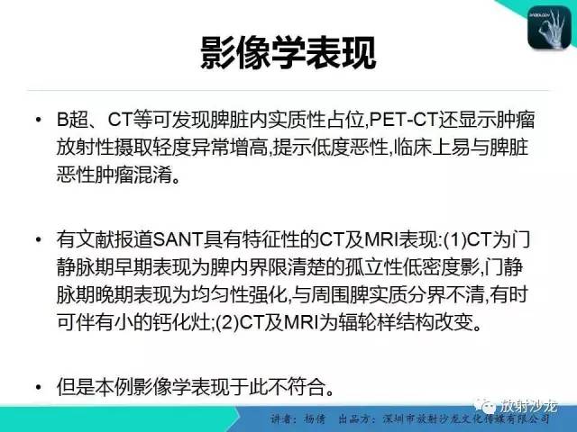 【病例】脾硬化性血管瘤1例CT影像表现与鉴别