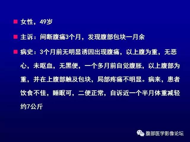 【病例】腹膜后副神经节瘤1例CT影像表现