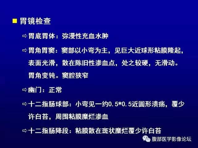 【病例】腹膜后副神经节瘤1例CT影像表现 【病例】腹膜后副神经节瘤1例CT影像表现