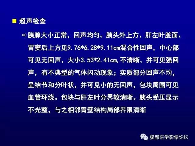 【病例】腹膜后副神经节瘤1例CT影像表现 【病例】腹膜后副神经节瘤1例CT影像表现