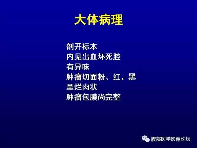 【病例】腹膜后副神经节瘤1例CT影像表现 【病例】腹膜后副神经节瘤1例CT影像表现
