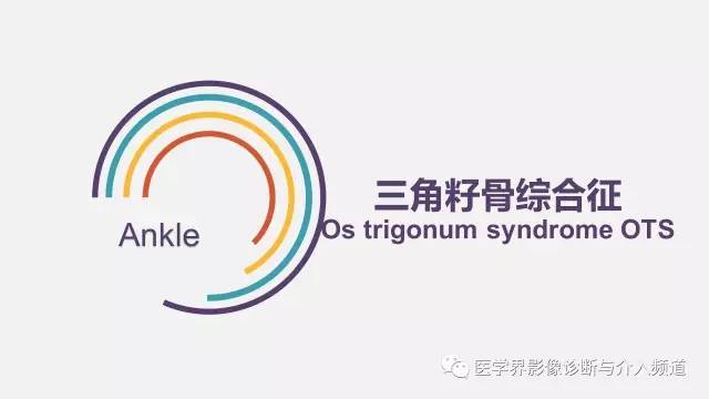 【PPT】三角籽骨综合征