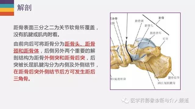 【PPT】三角籽骨综合征