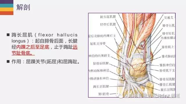 【PPT】三角籽骨综合征