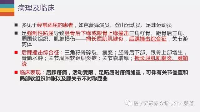 【PPT】三角籽骨综合征