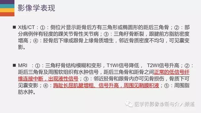 【PPT】三角籽骨综合征