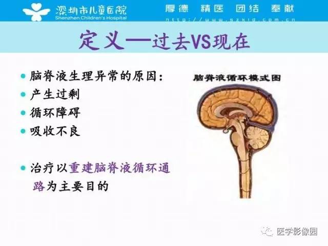 【PPT】儿童脑积水的MRI检查规范及新进展