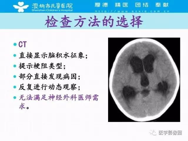 【PPT】儿童脑积水的MRI检查规范及新进展
