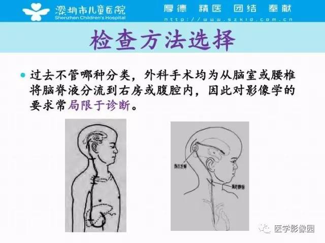 【PPT】儿童脑积水的MRI检查规范及新进展