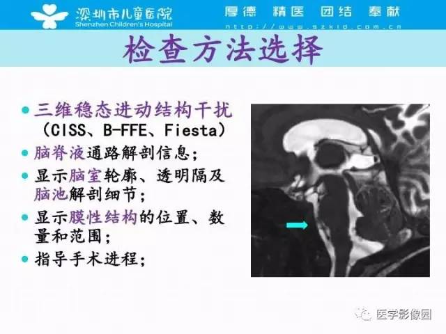 【PPT】儿童脑积水的MRI检查规范及新进展