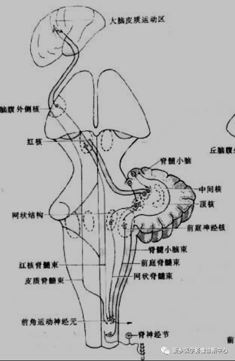 中脑这个常见的DWI高信号,您知道是为神马么? 中脑这个常见的DWI高信号,您知道是为神马么?