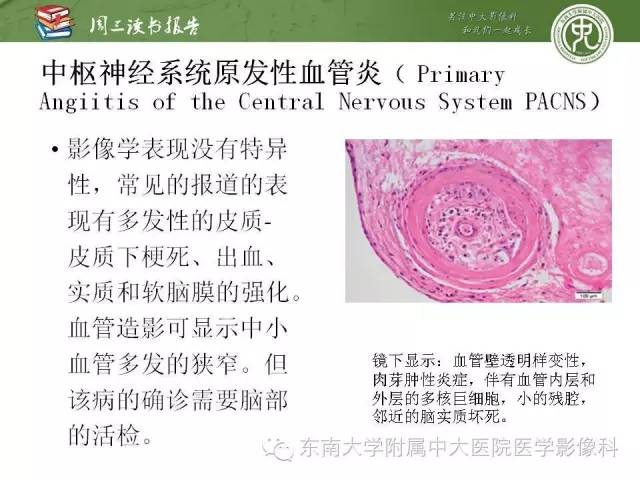 【PPT】脑白质疾病：影像和病理的相关性