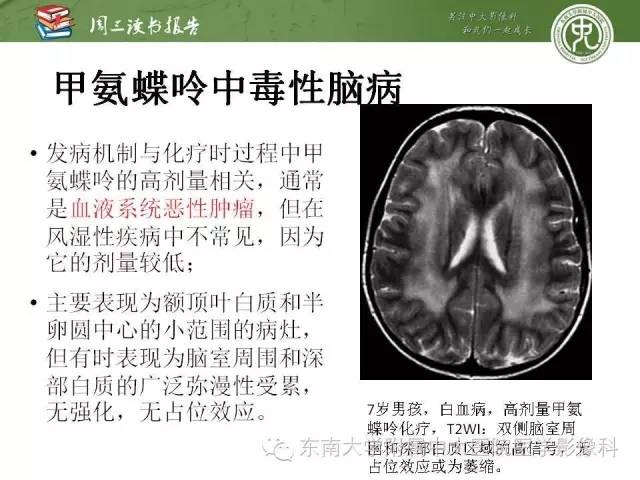 【PPT】脑白质疾病：影像和病理的相关性