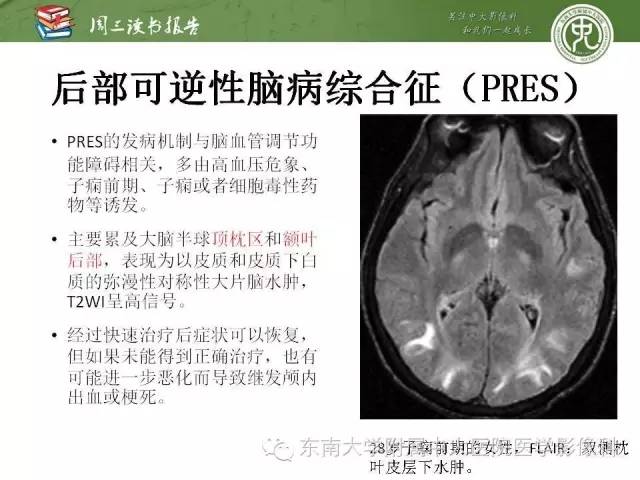 【PPT】脑白质疾病：影像和病理的相关性
