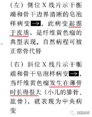 “长骨干骺端病变（皂泡样）”鉴别诊断