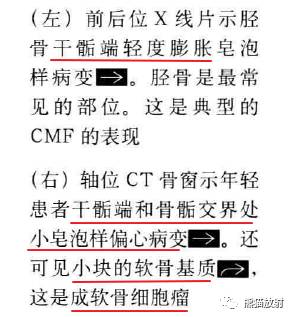 “长骨干骺端病变（皂泡样）”鉴别诊断