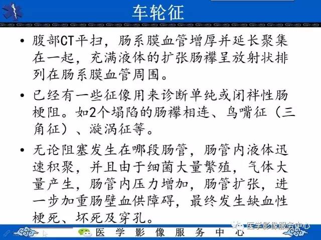 【影像征象】车轮征——小肠扭转