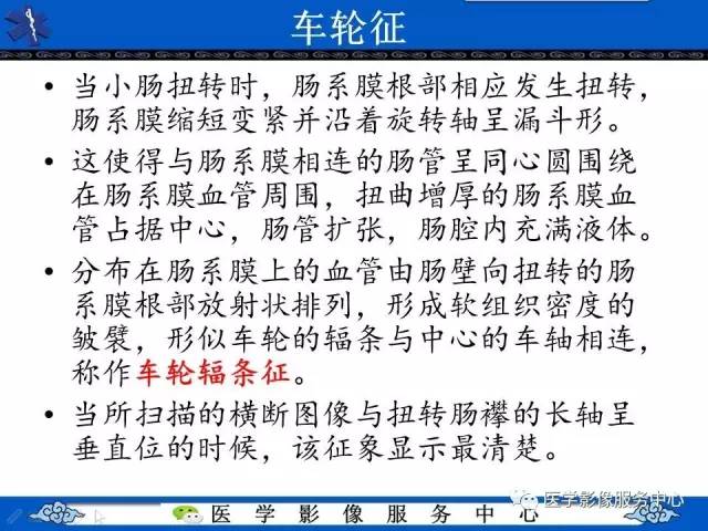 【影像征象】车轮征——小肠扭转