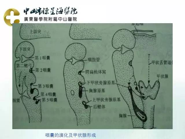 【PPT】鳃裂囊肿影像表现