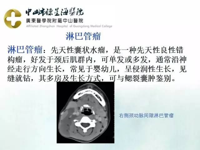 【PPT】鳃裂囊肿影像表现