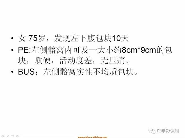 【病例】左侧髂窝区神经源性肿瘤1例CT影像表现