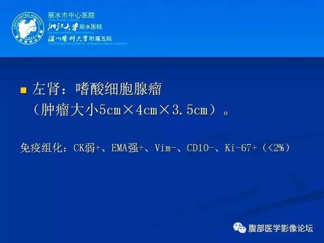 【病例】左肾嗜酸细胞腺瘤1例CT影像表现 【病例】左肾嗜酸细胞腺瘤1例CT影像表现