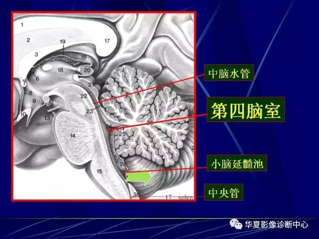 脑干解剖复习