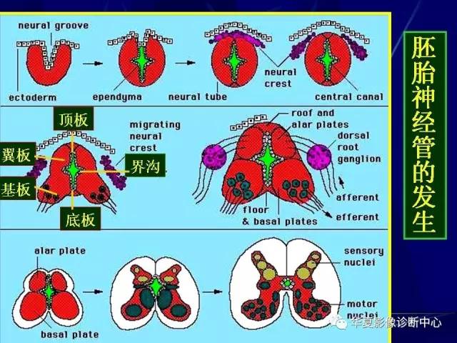 脑干解剖复习