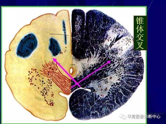 脑干解剖复习