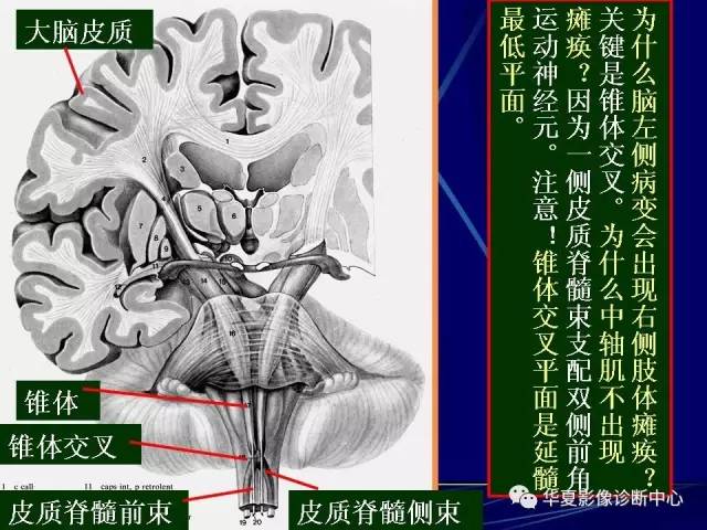 脑干解剖复习