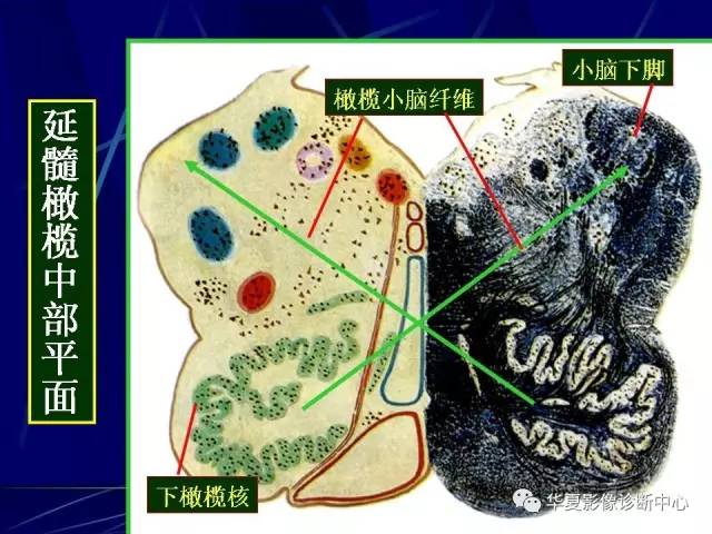 脑干解剖复习